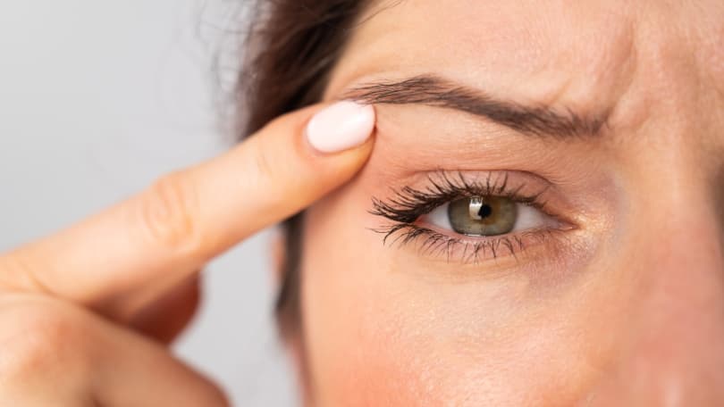 Blefaroplastia láser Co2 - Cirugía Parpados en Santander