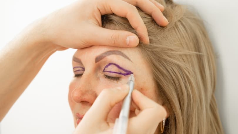 Ptosis palpebral - Cirugía Parpados en Santander