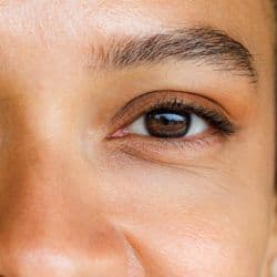 Tratamiento para ptosis de ceja en Santander